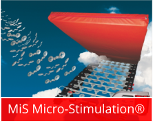 MiS Micro-Stimulation®